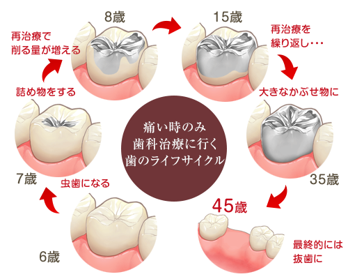 歯のライフサイクル