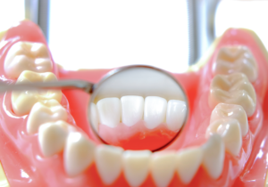 4月18日は「よい歯の日」定期検診を受けましょう！