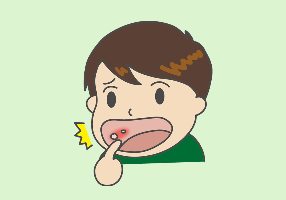 口内炎のある男の子